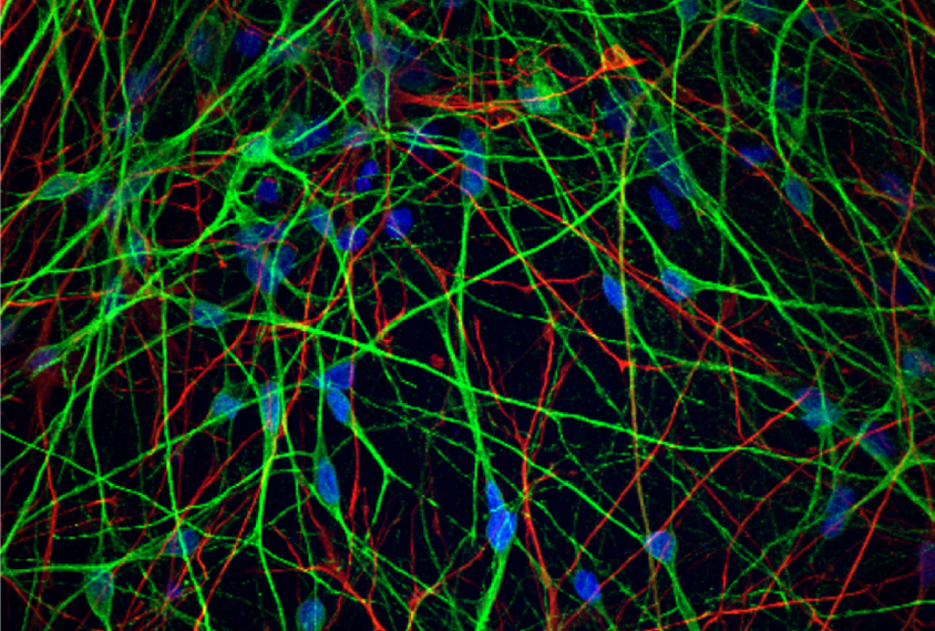 Astrocytes fuel erratic firing in fragile X neurons | Spectrum | Autism Research News