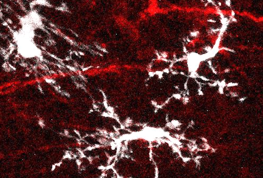 Grafted organoids reveal how microglia adapt to shifting brain environments | Spectrum | Autism Research News