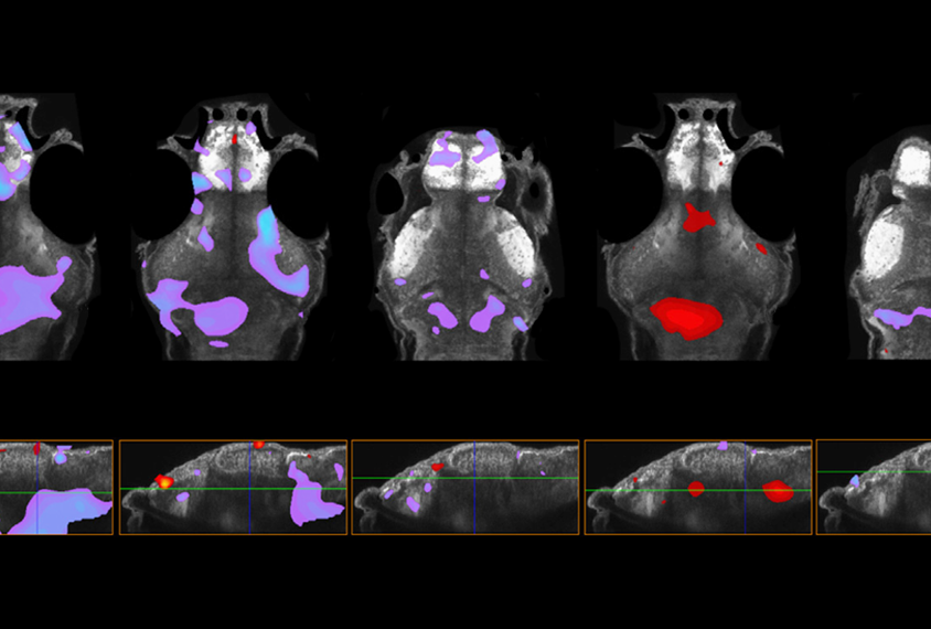 Autism-related genes converge on microglia and dopamine in zebrafish | Spectrum | Autism Research News