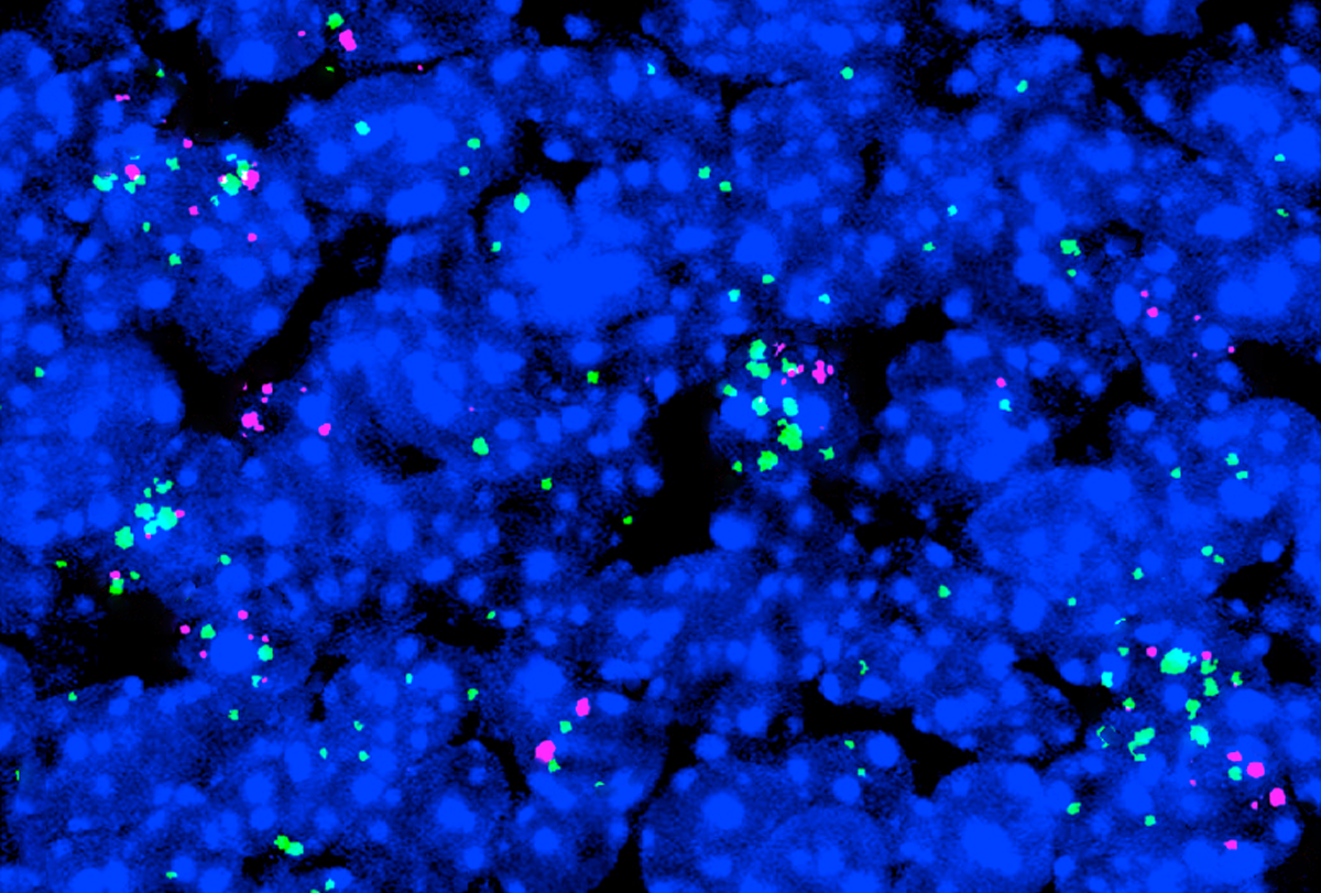 ‘Gain-of-function’ mutation spawns autism traits | Spectrum | Autism Research News