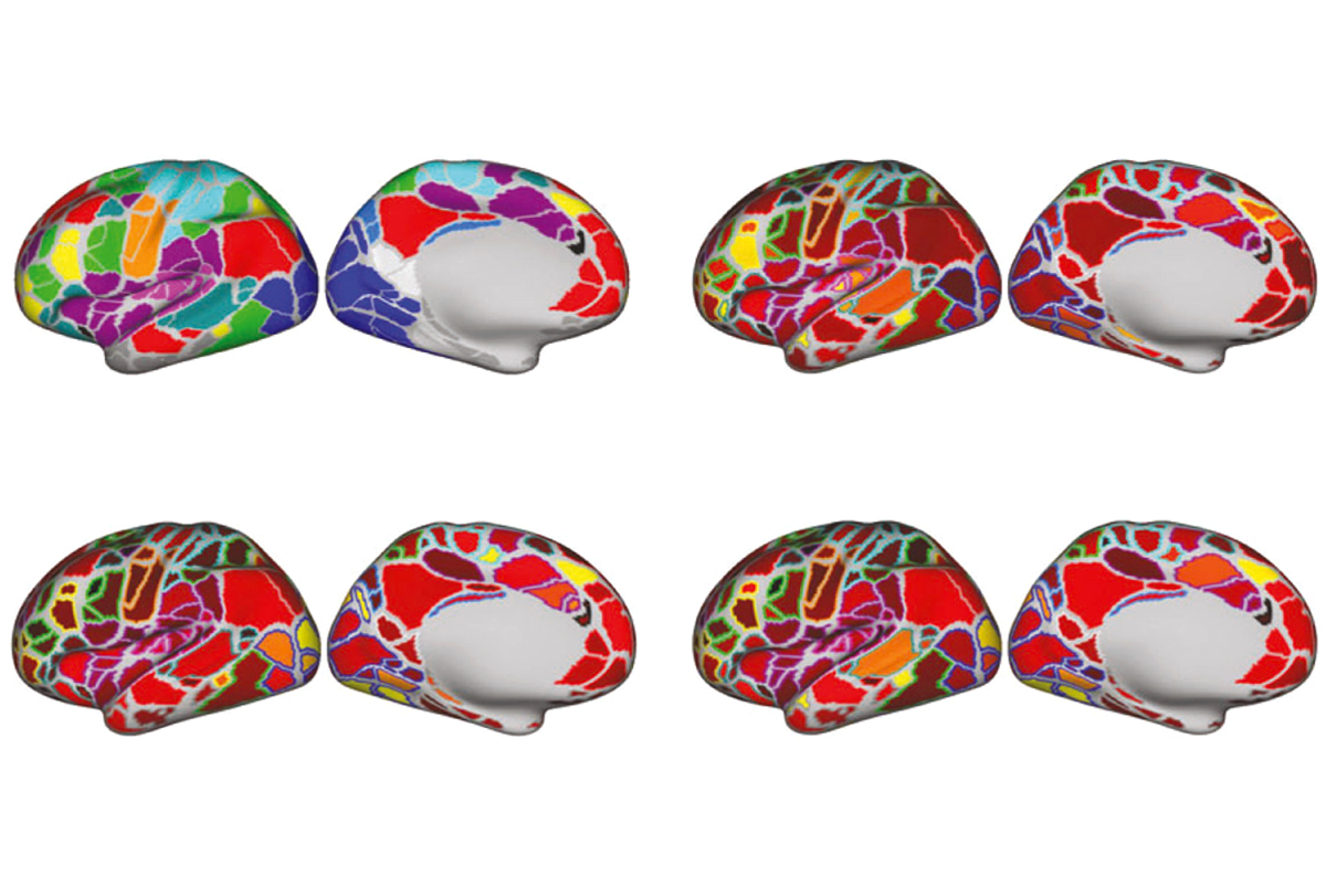 Statistical method improves behavioral predictions from fMRI | Spectrum | Autism Research News