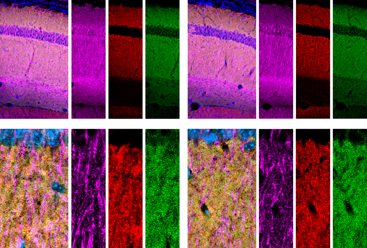 Dispute erupts over role of sticky proteins in astrocytes | Spectrum | Autism Research News