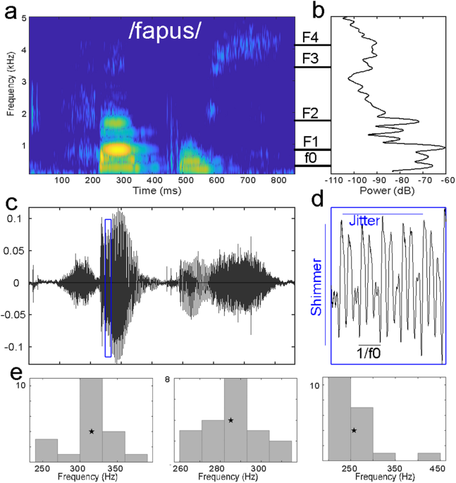 Voice acoustics allow classifying autism spectrum disorder with high accuracy | Translational Psychiatry