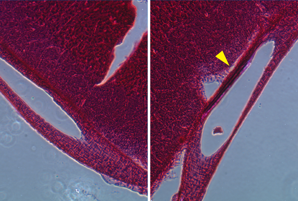 Brain-surgery-free probes can record single-neuron activity | Spectrum | Autism Research News