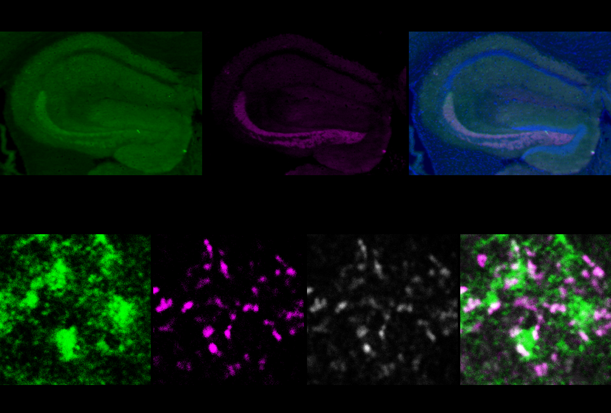 Some social issues in DYRK1A model mice stem from faulty inhibitory circuits | Spectrum | Autism Research News