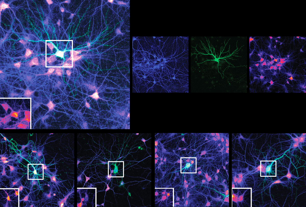 Mutations in multipurpose gene deal dendrites a double whammy | Spectrum | Autism Research News