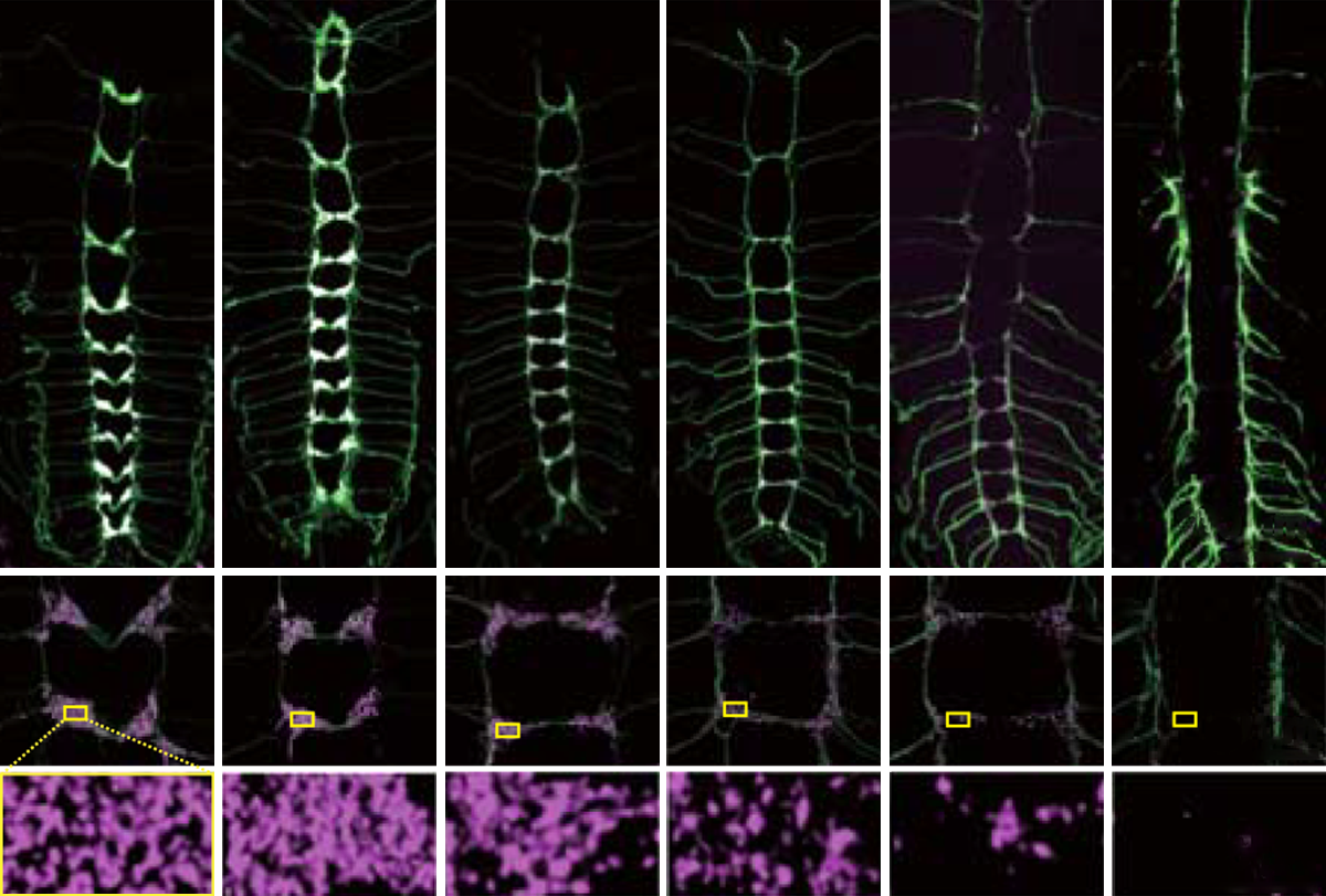 UBE3A’s link to synaptic pruning bolstered by fly study | Spectrum | Autism Research News