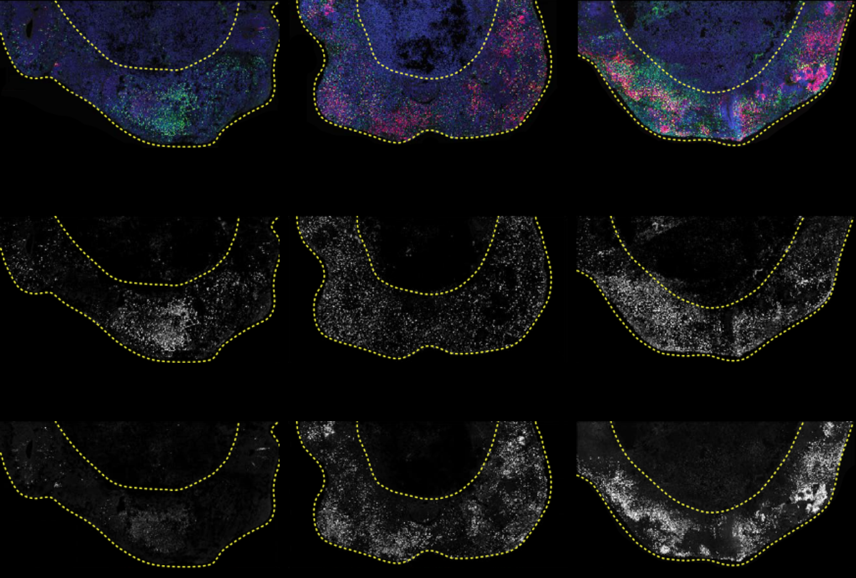 Method pinpoints cell-specific effects of autism-linked mutations | Spectrum | Autism Research News