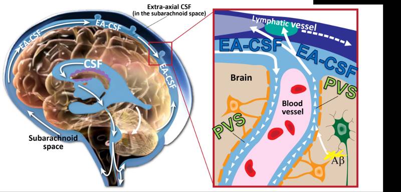 Enlarged Spaces in Infant Brains Linked to Higher Risk of Autism, Sleep Problems